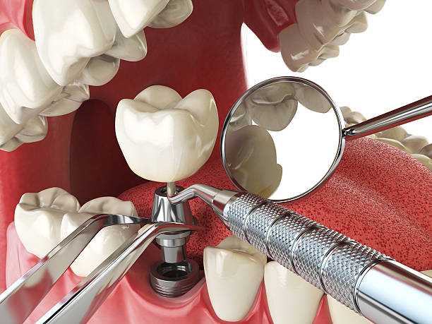 Best Emergency Cosmetic Dentistry (e.g., broken veneers) in Olivehurst, CA